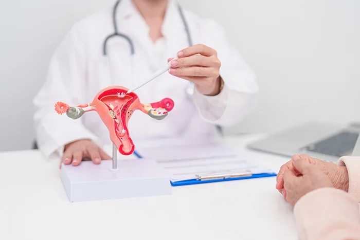 Tumore ovarico, 9 donne su 10 curate in centri specializzati entro il 2030